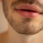 aumento de labios en hombre