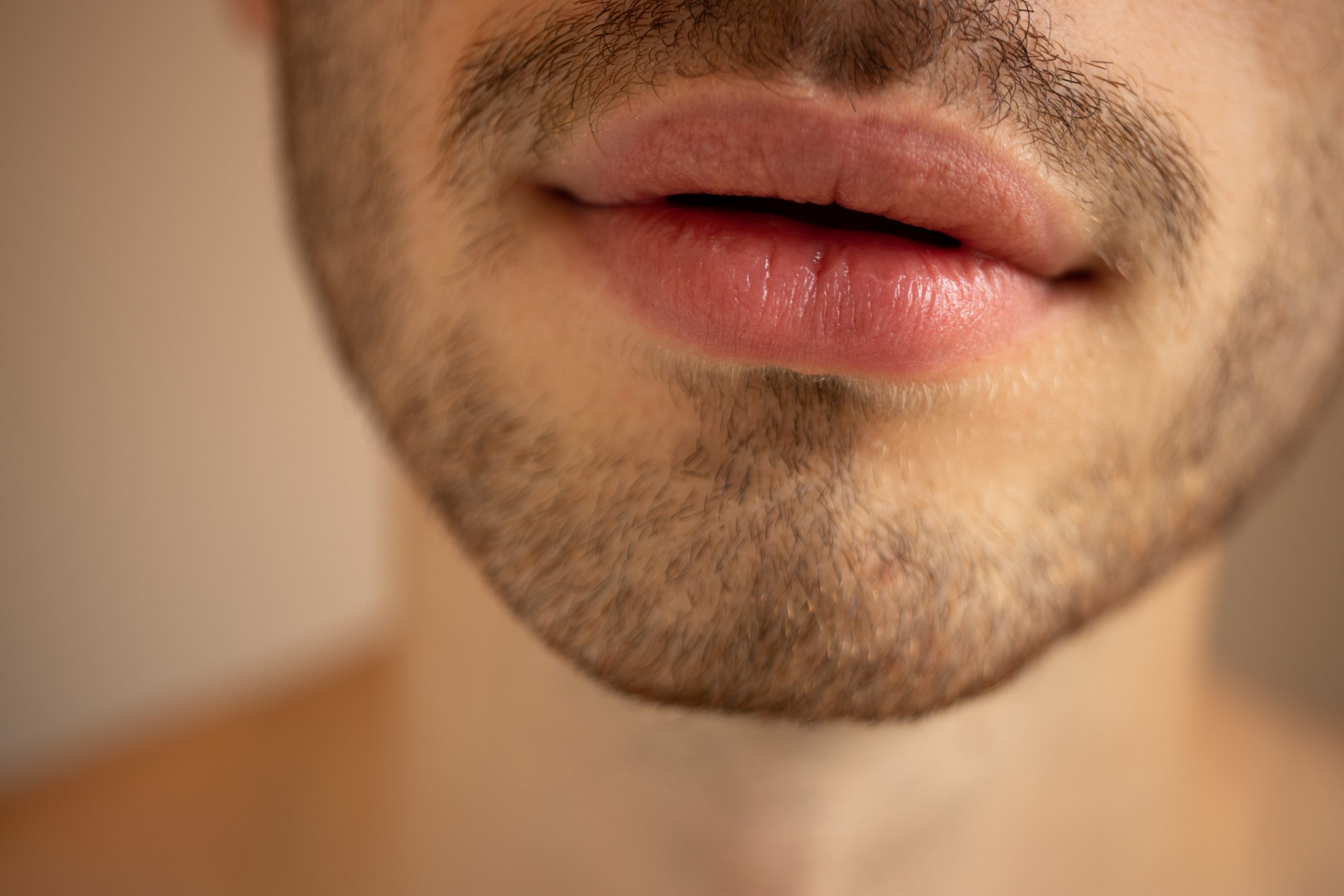 aumento de labios en hombre