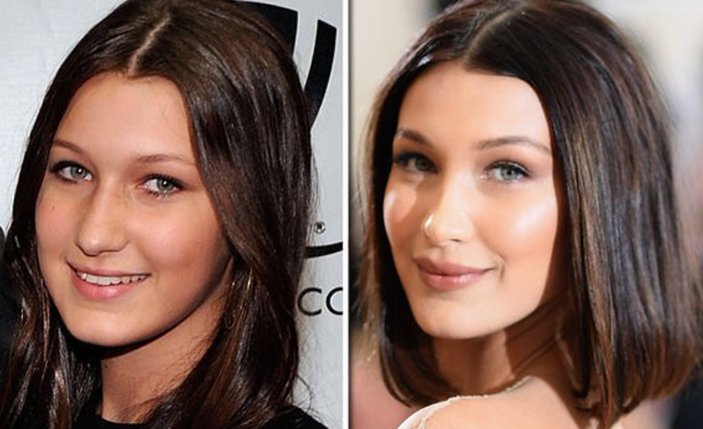 famosas con aumento de labios