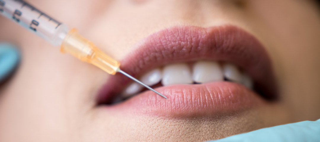 cuánto dura el ácido hialurónico en los labios