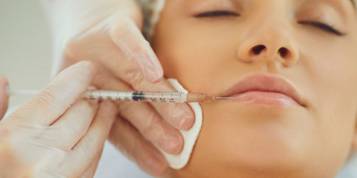 corrección de labios