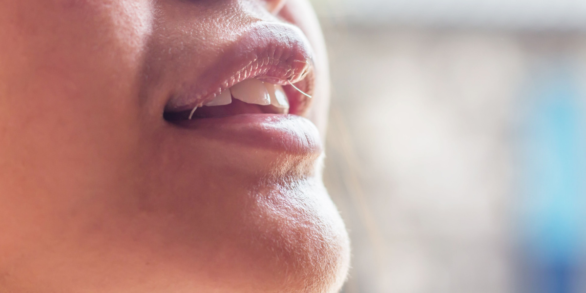 reducción de labios