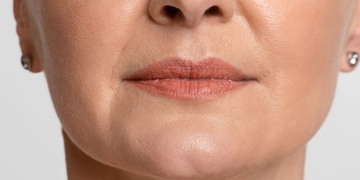 labios con arrugas