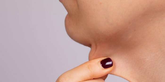 eliminar cuello de pavo