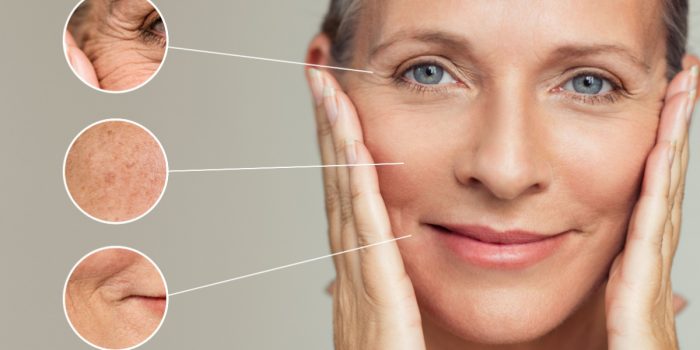 envejecimiento de la piel