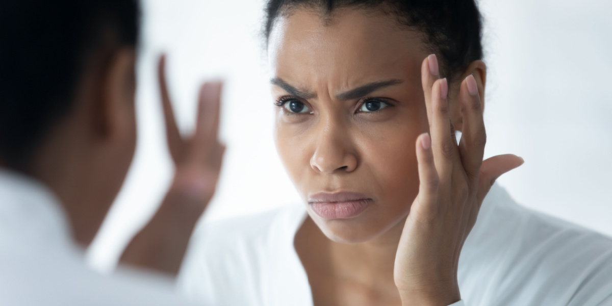 líneas de expresión