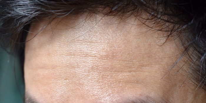 envejecimiento prematuro