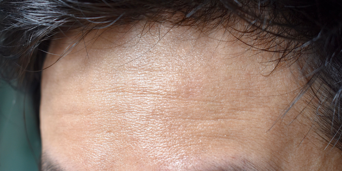 envejecimiento prematuro