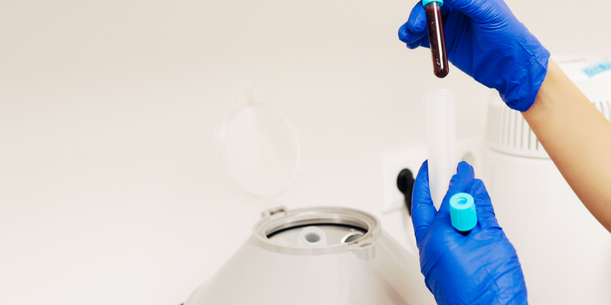 Plasma Rico en Plaquetas