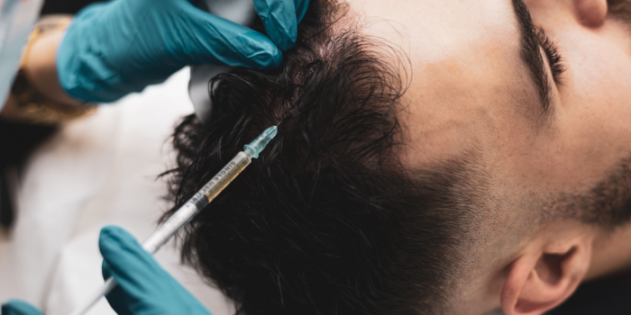 bioestimulación capilar