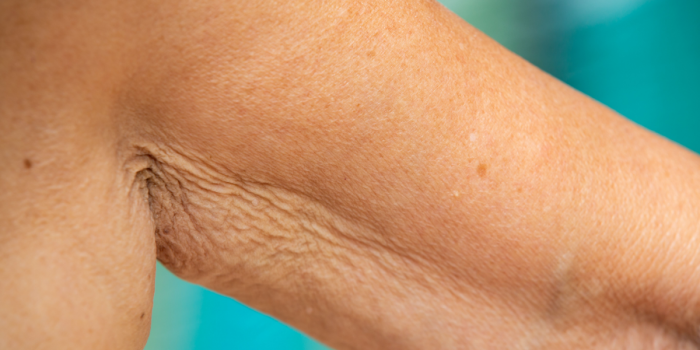 piel arrugada de los brazos