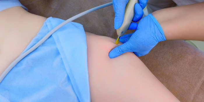 remodelación corporal