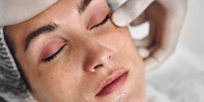 tratamientos estéticos ideales para el invierno