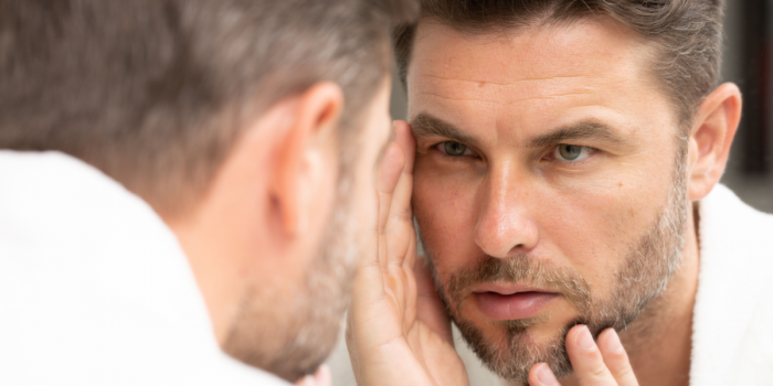 ¿Por qué tengo tantas arrugas en la cara_